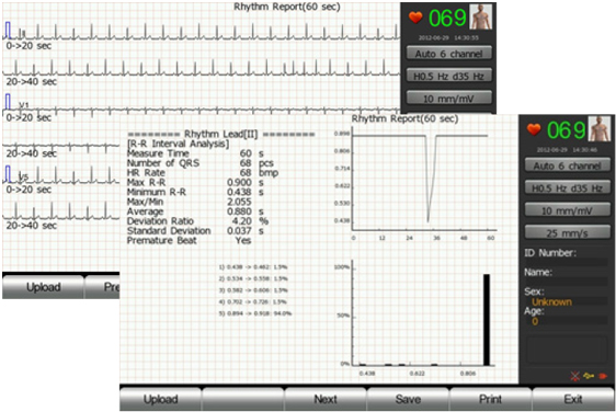 Máy đo điện tim 3 kênh EKG I - IG Medical Đức