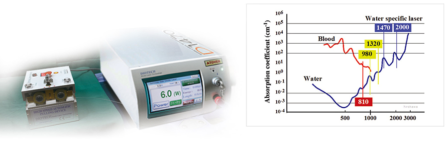 Máy điều trị suy tĩnh mạch chi dưới bằng Laser nội tĩnh mạch ATOVEN 147nm Diode Laser 3