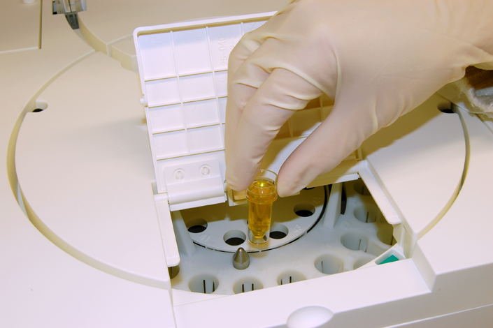 Máy phân tích sinh hoá tự động 270 test/h – Biolyzer 300 - Analyticon Đức